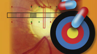 Rare protein-altering variants in ANGPTL7 lower intraocular pressure and protect against glaucoma featured image